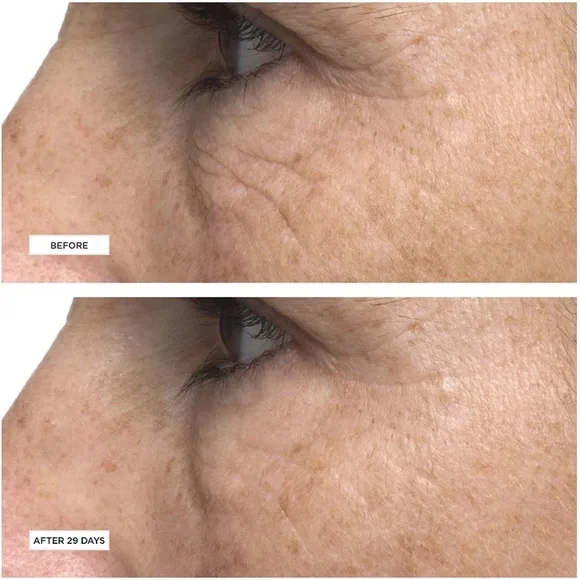 NIB Perricone MD Cold Plasma Plus+ Eye Cream
